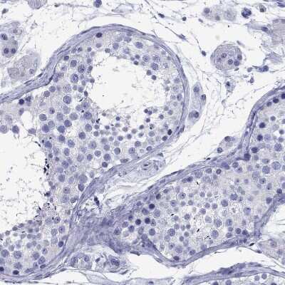 Immunohistochemistry-Paraffin: CD1a Antibody [NBP1-86560] - Staining of human testis shows no positivity in cells in seminiferous ducts as expected.