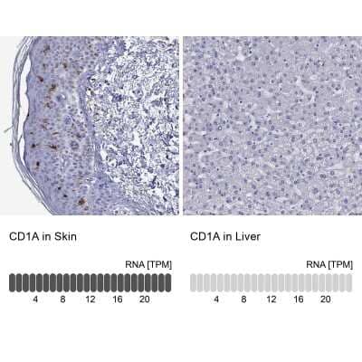 Immunohistochemistry-Paraffin: CD1a Antibody [NBP1-86560] - Analysis in human skin and liver tissues using NBP1-86560 antibody. Corresponding CD1A RNA-seq data are presented for the same tissues.