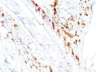 Immunohistochemistry-Paraffin: CD1a Antibody (O10+C1A/711) - Azide and BSA Free [NBP2-34698] - Formalin-fixed, paraffin-embedded human skin stained with CD1a MAb (O10+C1A/711).