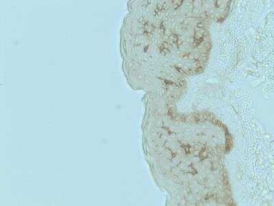 Immunohistochemistry-Paraffin: CD1a Antibody (O10) - Azide and BSA Free [NBP2-34697] - Human skin. Heat induced antigen retrieval in citrate buffer pH 6 at 95C for 20 minutes. Image from verified customer review.