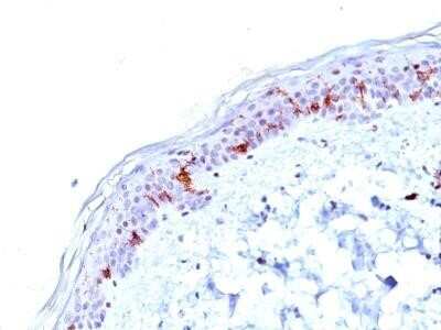 Immunohistochemistry-Paraffin: CD1a Antibody (O10) - IHC-Prediluted [NBP2-45341] - Formalin-fixed, paraffin-embedded  human skin stained with CD1a MAb (O10).