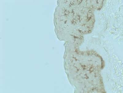 Immunohistochemistry: CD1a Antibody (O10) [NBP2-34313] - Immunohistochemistry-Paraffin: CD1a Antibody (O10) - Azide and BSA Free [NBP2-34697] - Human skin. Heat induced antigen retrieval in citrate buffer pH 6 at 95C for 20 minutes. Image from verified customer review.