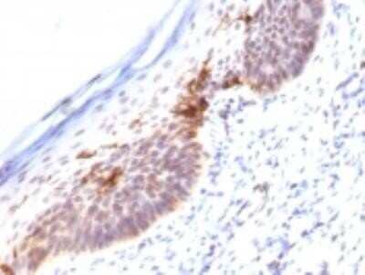 Immunohistochemistry-Paraffin: CD1a Antibody (SPM120) - Azide and BSA Free [NBP2-34731] - Formalin-fixed, paraffin-embedded human skin stained with CD1a Monoclonal Antibody (SPM120).