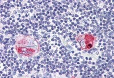 Immunohistochemistry-Paraffin: CD1b Antibody (SN13/K5-1B8) [NBP1-52580] - Analysis of anti-CD1B antibody with human thymus at concentration 20 ug/ml.