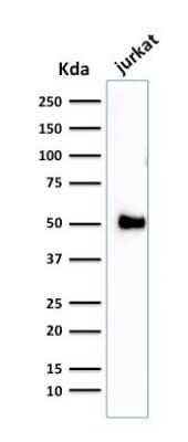 Western Blot: CD2 Antibody (1E7E8.G4) [NBP2-32814] - Western Blot Analysis of Jurkat cell lysate using CD2 Antibody (1E7E8.G4).