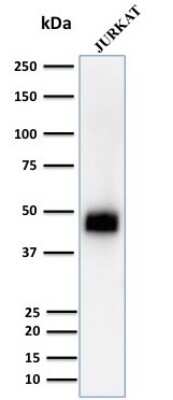 Western Blot: CD2 Antibody (UMCD2) [NBP2-32815] - Western Blot Analysis of Jurkat Cell lysate using CD2 Mouse Monoclonal Antibody (UMCD2).