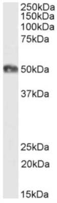 Western Blot: CD2 Antibody (YTH 655) - Chimeric [NBP2-81041] - Western Blot using anti-CD2 antibody (YTH 655) [NBP2-81041]. Human tonsil lysate samples (35ug protein in RIPA buffer) were resolved on a 10% SDS PAGE gel and blots probed with the chimeric rabbit version of YTH 655 [NBP2-81041] at 1 ug/ml before detection using an anti-rabbit secondary antibody. A primary incubation of 1h was used and protein was detected by chemiluminescence. The expected running size for unmodified CD2 is 39.5kDa, but this protein is glycosylated at several residues. NBP2-81041 successfully detected CD2 in human tonsil lysate.