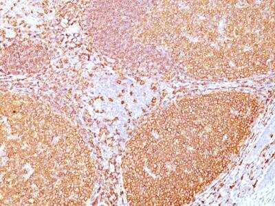 Immunohistochemistry-Paraffin: CD20 Antibody (IGEL/773) - IHC-Prediluted [NBP2-48335] - Formalin-fixed, paraffin-embedded human Tonsil.
