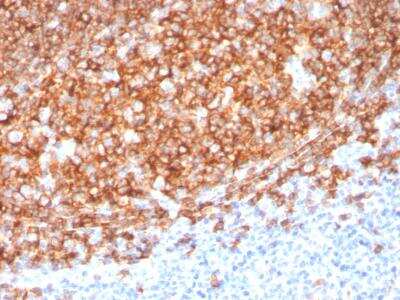 Immunohistochemistry-Paraffin: CD20 Antibody (MS4A1/3410) - Azide and BSA Free [NBP2-78052] - Formalin-fixed, paraffin-embedded human Tonsil