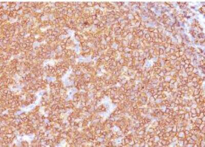 Immunohistochemistry-Paraffin: CD20 Antibody (SPM618) - IHC-Prediluted [NBP2-48336] - Formalin-fixed, paraffin-embedded human Tonsil.
