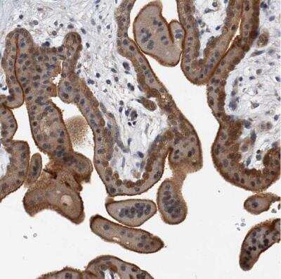 Immunohistochemistry-Paraffin: CD200/OX2 Antibody [NBP1-87738] - Staining of human placenta shows moderate to strong membranous positivity in trophoblastic cells.