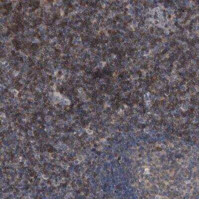 Immunohistochemistry-Paraffin: CD200/OX2 Antibody [NBP1-87738] - Staining of human tonsil shows moderate to strong membranous positivity in lymphoid cells.