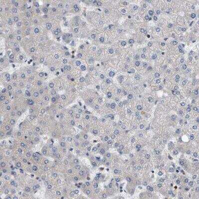 Immunohistochemistry-Paraffin: CD200/OX2 Antibody [NBP1-87738] - Staining of human liver shows no positivity in hepatocytes as expected.