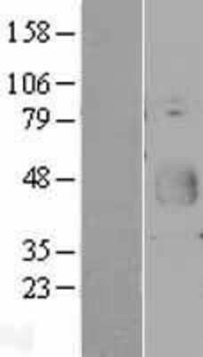 Western Blot: CD200/OX2 Overexpression Lysate (Adult Normal) [NBP2-04304] Left-Empty vector transfected control cell lysate (HEK293 cell lysate); Right -Over-expression Lysate for CD200/OX2.