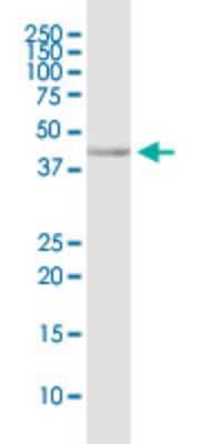 Western Blot: CD200 R1 Antibody [H00131450-D01P] - Analysis of CD200R1 expression in MCF-7.