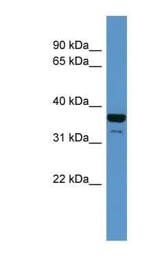 Western Blot: CD200R Antibody [NBP1-68990] - Human Liver cell lysate, concentration 0.2-1 ug/ml.