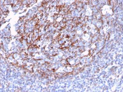 Immunohistochemistry-Paraffin: CD21 Antibody (CR2/3124R) - Azide and BSA Free [NBP3-08297] - Formalin-fixed, paraffin-embedded human Tonsil Dendritic stained with CD21 Recombinant Rabbit Monoclonal Antibody (CR2/3124R).