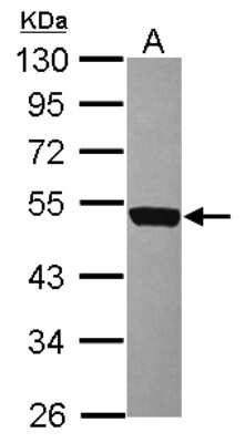 Western Blot: DNAM-1/CD226 Antibody [NBP2-15787] -  Sample (30 ug of whole cell lysate) A: Jurkat 10% SDS PAGE gel, diluted at 1:2000.