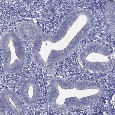 Immunohistochemistry-Paraffin: CD23/Fc epsilon RII Antibody [NBP3-16985] - Staining of human endometrium shows low expression as expected.