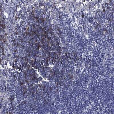 Immunohistochemistry-Paraffin: CD23/Fc epsilon RII Antibody [NBP3-16985] - Staining of human lymph node shows high expression.