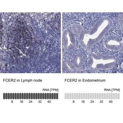 Immunohistochemistry-Paraffin: CD23/Fc epsilon RII Antibody [NBP3-16985] - Analysis in human lymph node and endometrium tissues using Anti-FCER2 antibody. Corresponding FCER2 RNA-seq data are presented for the same tissues.