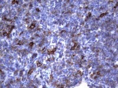 Immunohistochemistry: CD23/Fc epsilon RII Antibody (OTI2B6) - Azide and BSA Free [NBP2-70701] - Analysis of Human lymphoma tissue. (Heat-induced epitope retrieval by 10mM citric buffer, pH6.0, 120C for 3min)