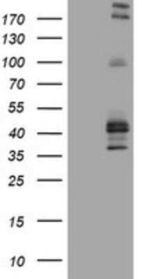 Western Blot: CD23/Fc epsilon RII Antibody (OTI2B6) - Azide and BSA Free [NBP2-70701] - Analysis of HEK293T cells were transfected with the pCMV6-ENTRY control (Left lane) or pCMV6-ENTRY CD23.