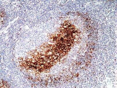 Immunohistochemistry-Paraffin: CD23/Fc epsilon RII Antibody (RM406) [NBP2-89088] - Immunohistochemical staining of formalin fixed and paraffin embedded human tonsil tissue section using Anti-CD23 Rabbit Monoclonal Antibody (Clone RM406) at a 1:200 dilution.