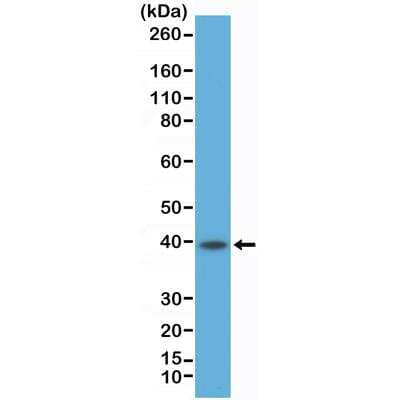 Western Blot: CD23/Fc epsilon RII Antibody (RM406) [NBP2-89088] - Western Blot of Raji cell lysate using Anti-CD23 rabbit monoclonal antibody (Clone RM406) at a 1:500 dilution.