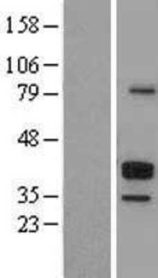 Western Blot CD23/Fc epsilon RII Overexpression Lysate