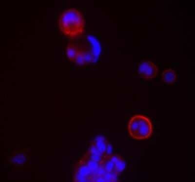 Immunocytochemistry/Immunofluorescence: CD24 Antibody (ML5) - Azide and BSA Free [NBP2-80636] - MCF-7 breast cancer cells. Image from the standard format of this antibody.