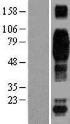 Western Blot: 2B4/CD244/SLAMF4 Overexpression Lysate [NBL1-08924] - Left-Empty vector transfected control cell lysate (HEK293 cell lysate); Right -Over-expression Lysate for CD244.