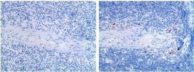 Immunohistochemistry-Paraffin: CD25/IL-2 R alpha Antibody (AP-MAB0710) [NB110-97867] -  Formalin fixed and paraffin embedded mouse spleen tissue section was subjected to immunohistochemistry staining of CD25.