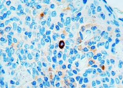 Immunohistochemistry-Paraffin: CD25/IL-2 R alpha Antibody (IL2R.1) [NB600-564] - Human Tonsil