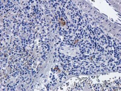 Immunohistochemistry: CD25/IL-2R alpha Antibody (Basiliximab) - Chimeric [NBP2-75902] - Formalin fixed rat spleen slices were were stained with a NBP2-75902 at 5 ug/ml. The anti-human CD25 antibody NBP2-75902 also shows some cross-reactivity with rat in IHC.