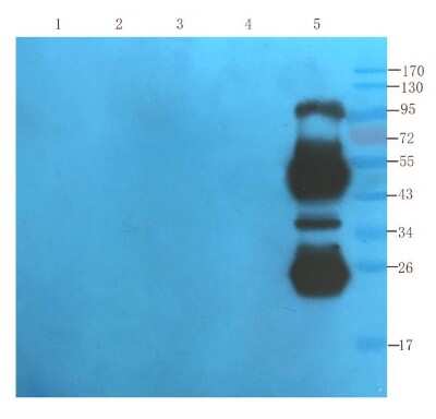 Western Blot: CD25/IL-2R alpha Antibody (Daclizumab) [NBP2-75901] - Mouse lipocyte (lane 1), mouse spleen (lane 2), mouse thymus (lane 3), mouse lymph node (lane 4) and human thyroid tumour (lane 5) samples were resolved on a 10% SDS PAGE gel and blots probed with NBP2-75901 at 1.5 ug/ml before being detected by a secondary antibody. The expected band size (31 kDa) is seen in the human-derived sample, as well as further bands that are specific to human.