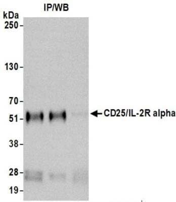 Immunoprecipitation: CD25/IL-2R alpha Antibody [NBP3-14733] - Whole cell lysate (0.5 mgper IP reaction; 5% of IP loaded) from MJ cells preparedusing NETN lysis buffer. Antibodies: Rabbit antiCD25/IL-2R alpha recombinant monoclonal antibody used for IP at 20 ul/mg lysate.CD25/IL-2R alpha was also immunoprecipitated by anotherantibody against a different epitope of CD25/IL-2R alpha. For blotting immunoprecipitatedCD25/IL-2R alpha, was used at 1:1000.Chemiluminescence with an exposure time of 30 seconds.