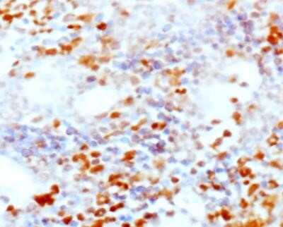 Immunohistochemistry: CD25/IL-2R alpha Antibody (PC61.5.3) - Azide and BSA Free [NBP2-80637] - Analysis of formalin-fixed paraffin-embedded tissue section of spleen from normal Mouse using CD25/IL-2 R alpha antibody (clone PC61.5.3.) at 1:100 dilution. Image from the standard format of this antibody.