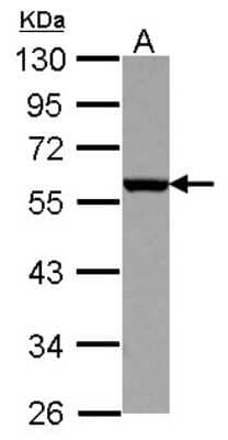 Western Blot: CD27 Antibody [NBP2-15790] - Sample (30 ug of whole cell lysate) A: K562 10% SDS PAGE gel, diluted at 1:10000.