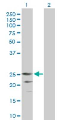 Western Blot: CD27 Ligand/TNFSF7/CD70 Antibody [H00000970-B01P] - Analysis of CD70 expression in transfected 293T cell line by CD70 polyclonal antibody.  Lane 1: CD70 transfected lysate(21.23 KDa). Lane 2: Non-transfected lysate.