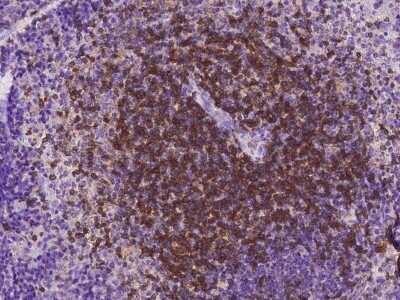 Immunohistochemistry-Paraffin: CD27/TNFRSF7 Antibody (618) [NBP2-90425] - Staining of mouse CD27/TNFRSF7 in mouse spleen with rabbit monoclonal antibody at 1:200 dilution.