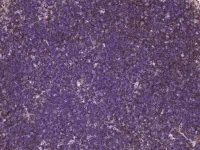 Immunohistochemistry-Paraffin: CD27/TNFRSF7 Antibody (618) [NBP2-90425] - Immunochemical staining of mouse CD27/TNFRSF7 in mouse thymus with rabbit monoclonal antibody at 1:200 dilution, formalin-fixed paraffin embedded sections.