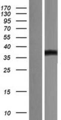 Western Blot B7-H3/CD276 Overexpression Lysate