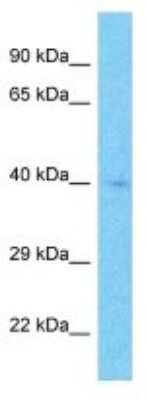 Western Blot: CD277/BTN3A1 Antibody [NBP3-10705] - Western blot analysis of CD277/BTN3A1 in HepG2 Whole Cell lysates. Antibody dilution at 1.0ug/ml