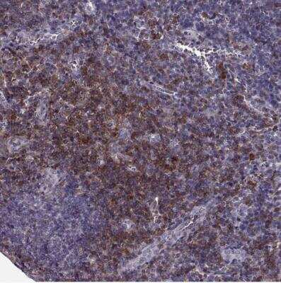 Immunohistochemistry-Paraffin: CD28 Antibody [NBP2-57015] - Staining of human tonsil shows moderate membranous positivity in lymphocytes.