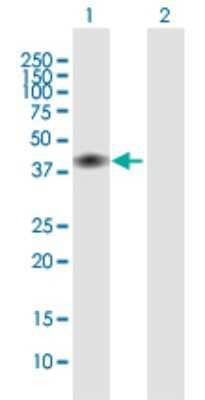 Western Blot: CD28 Antibody [H00000940-B01P] - Analysis of CD28 expression in transfected 293T cell line by CD28 polyclonal antibody.  Lane 1: CD28 transfected lysate(24.2 KDa). Lane 2: Non-transfected lysate.