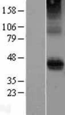 Western Blot: CD28 Overexpression Lysate (Adult Normal) [NBP2-04308] Left-Empty vector transfected control cell lysate (HEK293 cell lysate); Right -Over-expression Lysate for CD28.