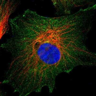 Immunocytochemistry/Immunofluorescence: CD2AP Antibody [NBP1-90626] - Staining of human cell line U-251 MG shows localization to plasma membrane and cytosol. Antibody staining is shown in green.