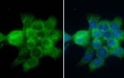 Immunocytochemistry/Immunofluorescence: CD2AP Antibody [NBP2-53098] - A431 cells were fixed in ice-cold MeOH for 5 min. Green: CD2AP stained by CD2AP antibody diluted at 1:500.Blue: Fluoroshield with DAPI. 