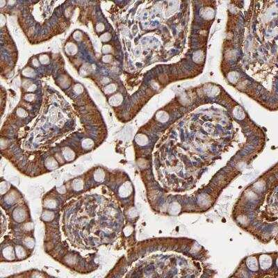 Immunohistochemistry-Paraffin: CD2AP Antibody [NBP1-90625] - Staining of human small intestine shows strong granular positivity in cytoplasm in glandular cells.